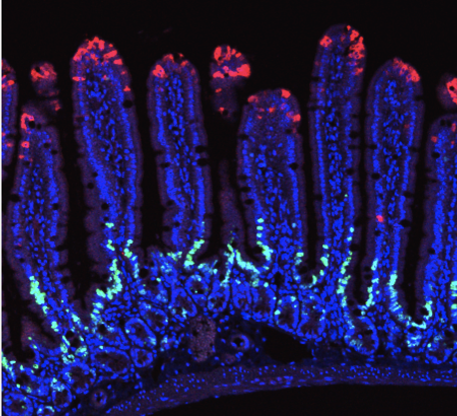 Zonation of ribosomal DNA transcription defines a stem cell hierarchy ...